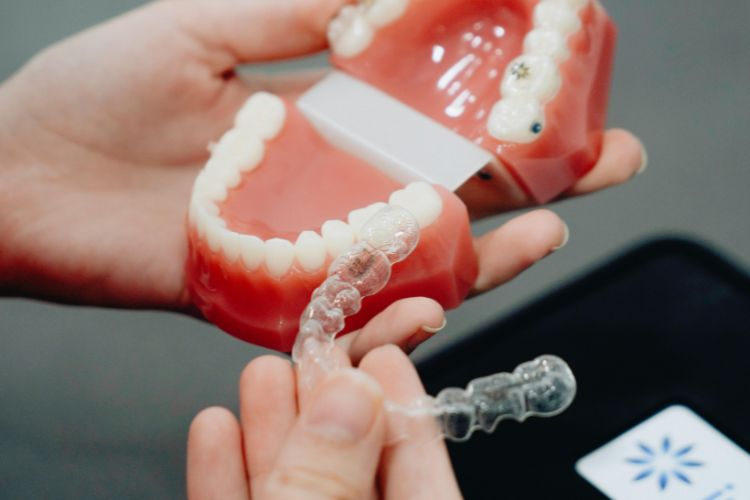 ferulas de invisalign
