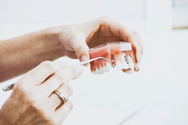 molde tornillo de implantes dentales