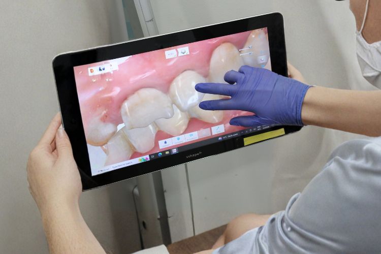 tac dental paciente